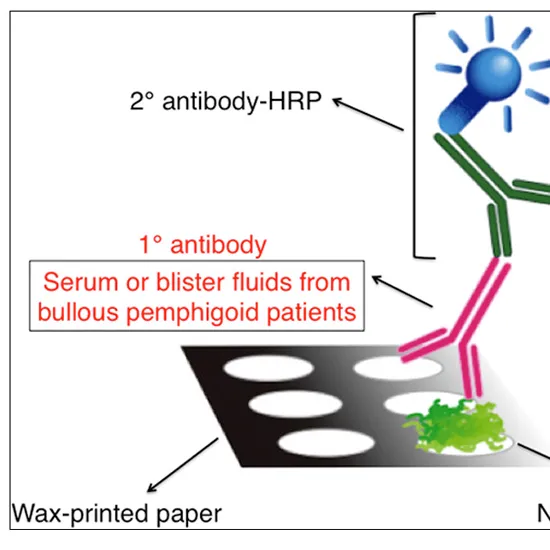 anti epidermal pemphigus antibody test